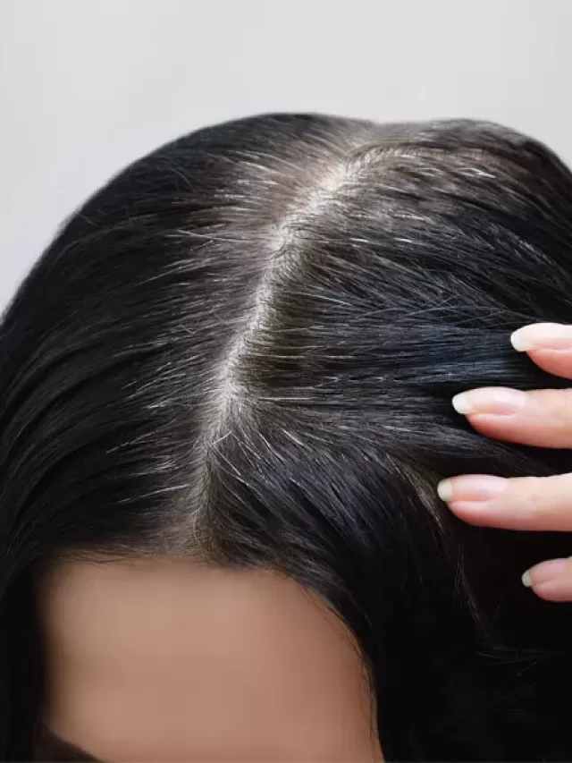 Home remedies for gray hair