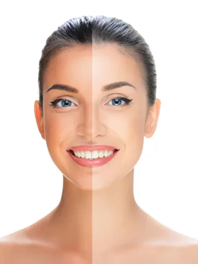 Simple Home Remedies To Remove Tan